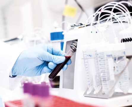Blood processing in a lab