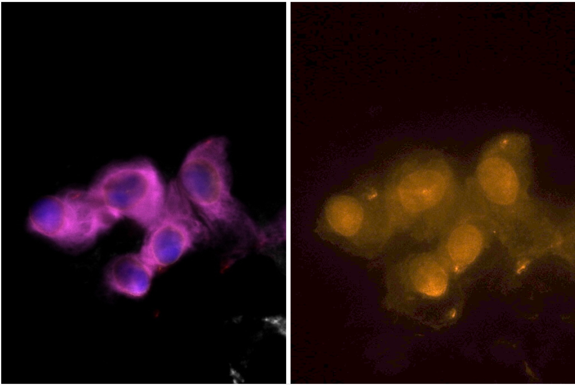 DNA damage response (DDR) assays for non-invasive treatment response monitoring