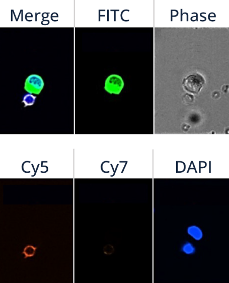 Imaging on BioView Allegro Plus system and CTC identification